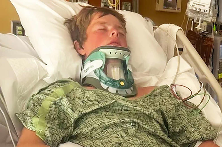 Teen breaks neck on last day of lifeguarding internship after hitting head on ocean floor