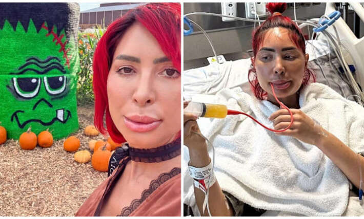 Farrah Abraham reveals jaw surgery after assault: ‘I feel like Frankenstein’