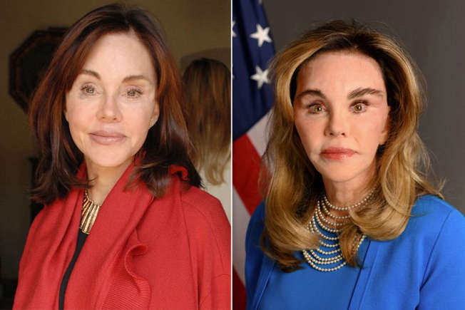 Worst Mar-a-Lago makeovers as Barbera Thornhill and Susan Dell come under fire