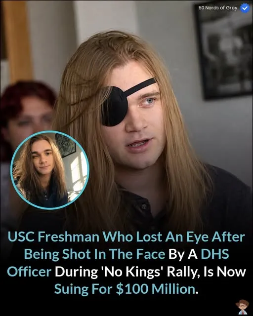 USC freshman who lost an eye after being shot in the face by a DHS officer